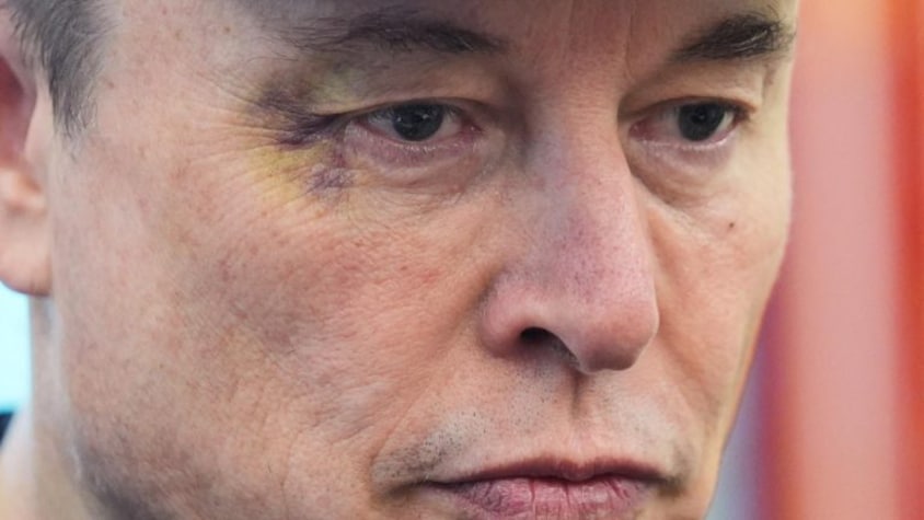 Elon Musk's black-eye: Truth behind the billionaire's bruised eye during Oval Office farewell